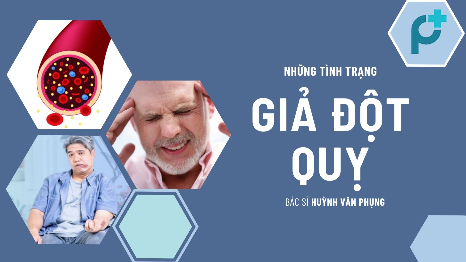 Chẩn đoán điều trị đột quỵ và Bệnh lý giả đột quỵ